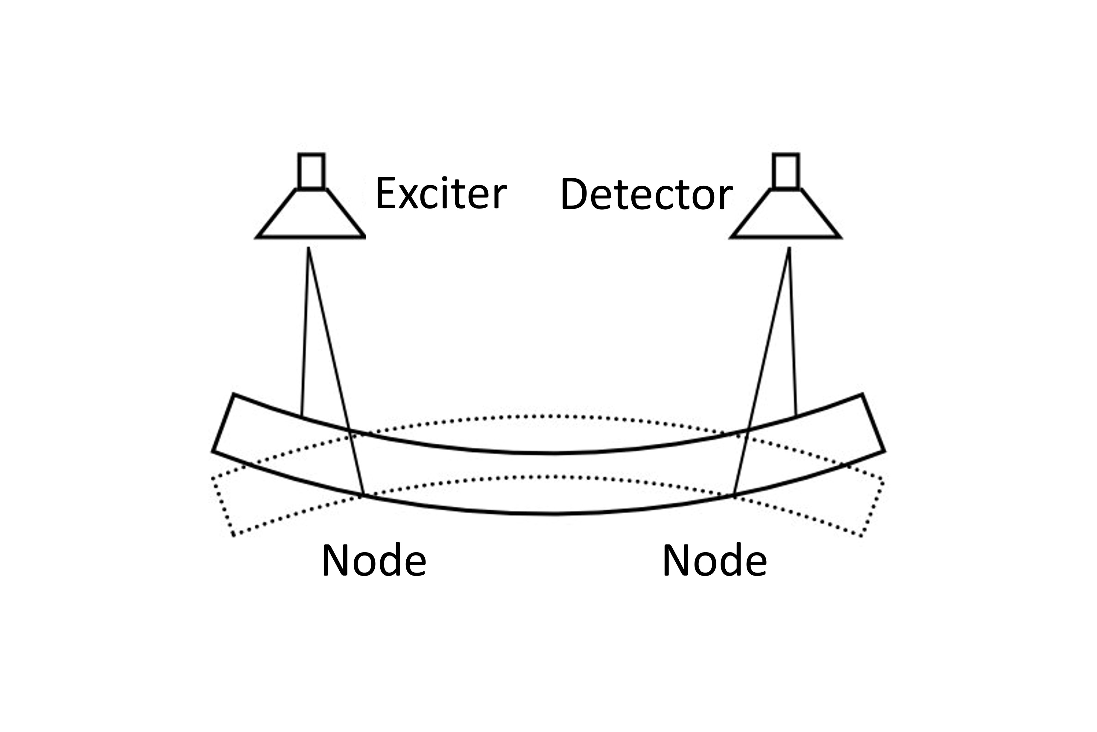 Suspension-wire driven type
